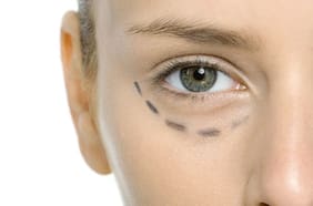 Ojeras de cuarentena: cómo combatirlas