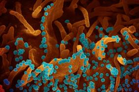 Elizabeth Fischer: La retratista del coronavirus