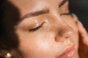 ¿Por qué Thiamidol es el ingrediente más efectivo¹ para tratar las manchas en la piel?