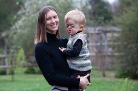 Tanya y Rai: “Mi hijo tiene síndrome de Apert”