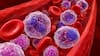 El fármaco que eliminó los marcadores de cáncer en el 78% de los pacientes de alto riesgo, en un ensayo clínico