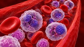 El fármaco que eliminó los marcadores de cáncer en el 78% de los pacientes de alto riesgo, en un ensayo clínico