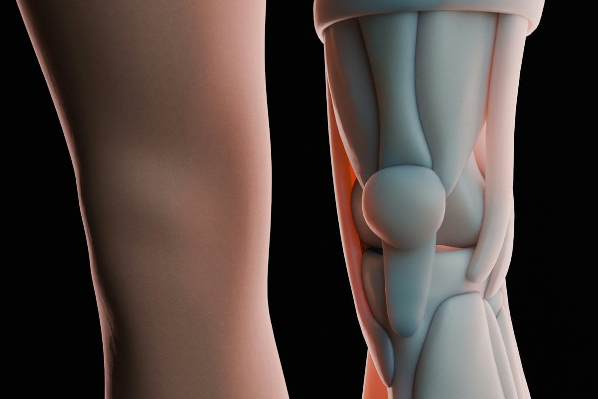 El hábito que pone en riesgo a las personas que padecen de osteoartritis en la rodilla, según un estudio