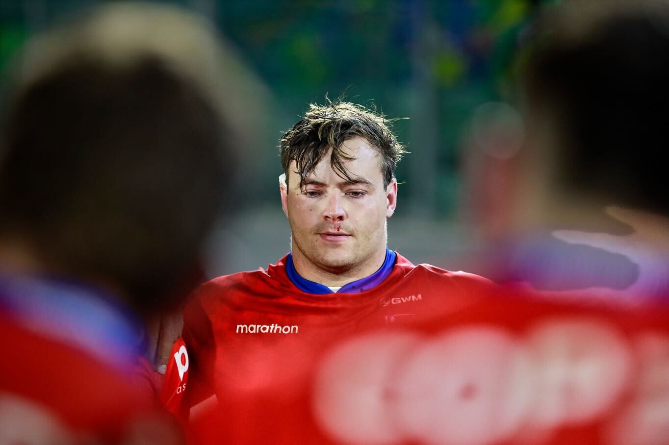 Aún falta otra intervención: Emilio Shea es operado tras su grave lesión que amenaza su presencia en el Mundial de Rugby