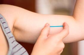 Qué tan eficaz y seguro es el implante anticonceptivo subcutáneo