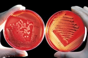 Qué es la listeria y cómo afecta a las personas esta bacteria por la que el Minsal emitió una alerta sanitaria