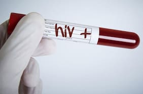 Científicos chilenos realizan importante hallazgo en la lucha contra el VIH: logran frenar multiplicación del virus a nivel celular