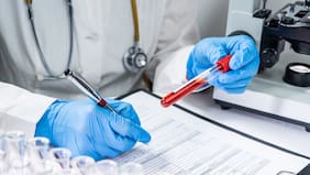 Cómo los exámenes de sangre podrían predecir el Alzheimer, según un reciente estudio