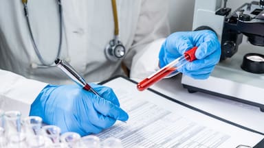 Cómo los exámenes de sangre podrían predecir el Alzheimer, según un reciente estudio