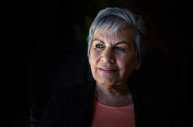 Estos rasgos en tu rostro pueden indicar que tienes un problema de salud, según los médicos