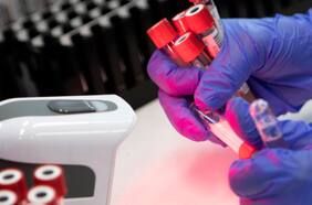 Las infecciones por SARS-CoV-2 superan por mucho lo reportado según los casos confirmados