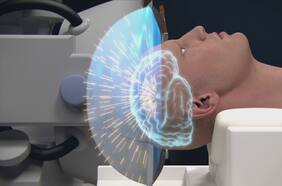 Científicos de Stanford sorprendidos por el descubrimiento de un posible tratamiento para el Parkinson