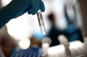 Diagnóstico de Covid-19 en 30 segundos con Inteligencia Artificial