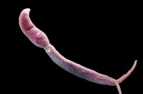 ¿Qué son las lombrices vampiro que atacan el hígado, el intestino y la vejiga y qué enfermedad provocan?