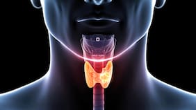 Cáncer de tiroides: qué es y cuáles son los factores de riesgo y las señales de alerta