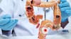 Cómo las células del cáncer de colon pueden cambiar de identidad para propagarse, según una investigación