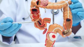 Cómo las células del cáncer de colon pueden cambiar de identidad para propagarse, según una investigación