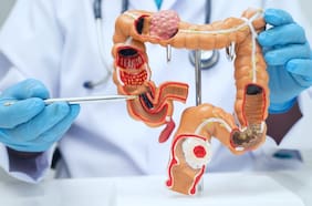 Cómo las células del cáncer de colon pueden cambiar de identidad para propagarse, según una investigación