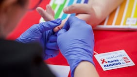 VIH fuera del foco: expertos alertan “apagón” en prevención y campañas en Chile