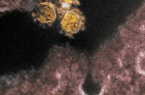 ¿Pueden los científicos predecir todas las formas en que evolucionará el coronavirus?