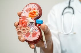 Por qué está aumentando el número de pacientes con enfermedad renal, según un estudio