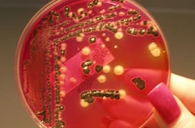 “Vampirismo bacteriano”: científicos descubren que muchas bacterias comunes se alimentan de sangre humana