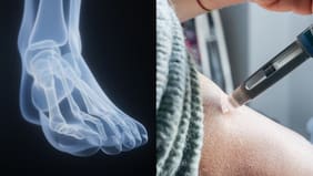 Las inyecciones de GLP-1 pueden aumentar el riesgo de lesiones en huesos, según un reciente estudio