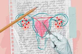 Reflexiones de una ex-histérica