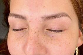 Freckling: la tendencia que crea pecas con micropigmentación