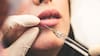 El boom del botox: su demanda sube 55%, y gasto en belleza y bienestar en Chile crece 48% en dos años