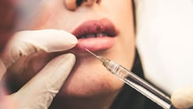 El boom del botox: su demanda sube 55%, y gasto en belleza y bienestar en Chile crece 48% en dos años
