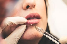 Por qué no convienen las promociones de bótox en redes sociales
