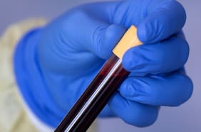 Plasma: la terapia usada en la gripe española que 100 años después le salvó la vida a un médico de San Antonio