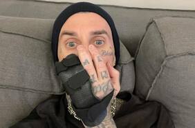 Travis Barker de Blink 182 deberá operarse la mano y extiende la incertidumbre en Lollapalooza Chile