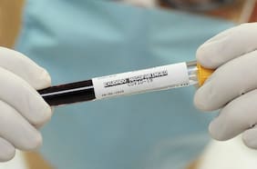 Paciente dice que sintió “fuego en las venas”: El coronavirus también sería una enfermedad sanguínea