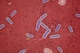 Qué es la listeria, la bacteria que fue encontrada en un lote de sándwiches de ave pimentón en Chile