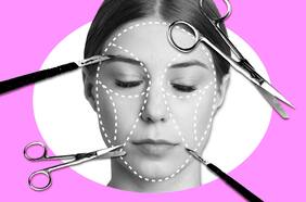 La vuelta de la bichectomía y caras ultra delgadas