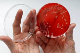 Qué es el ántrax, la enfermedad infecciosa que alerta a la OMS