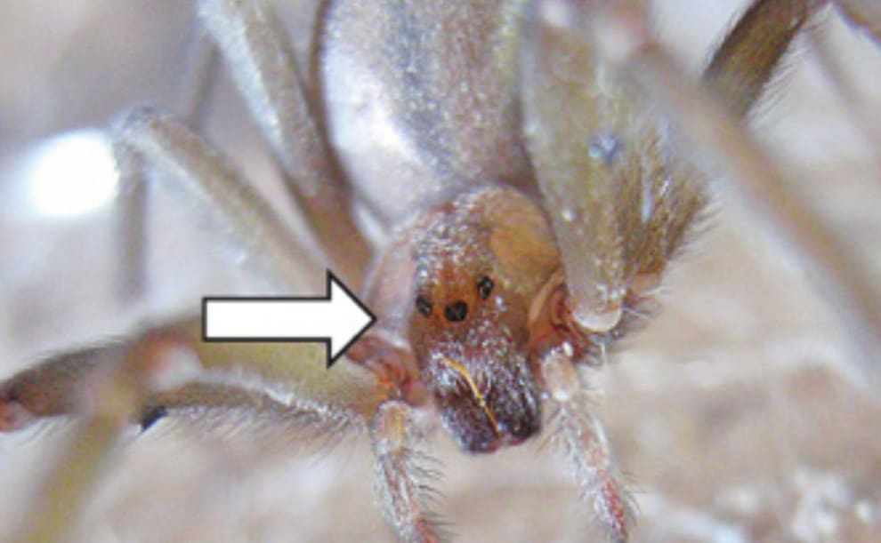 Temporada de araña de rincón: cómo reconocerla, síntomas y cómo actuar ...
