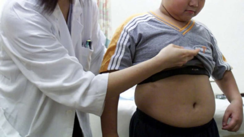 childhood obesity