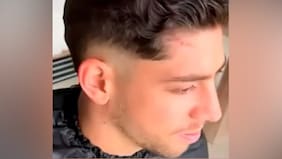 Con notoria cicatriz: Federico Valverde reaparece en Uruguay tras pelea con Aurélien Tchouaméni en el Real Madrid