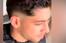 Con notoria cicatriz: Federico Valverde reaparece en Uruguay tras pelea con Aurélien Tchouaméni en el Real Madrid