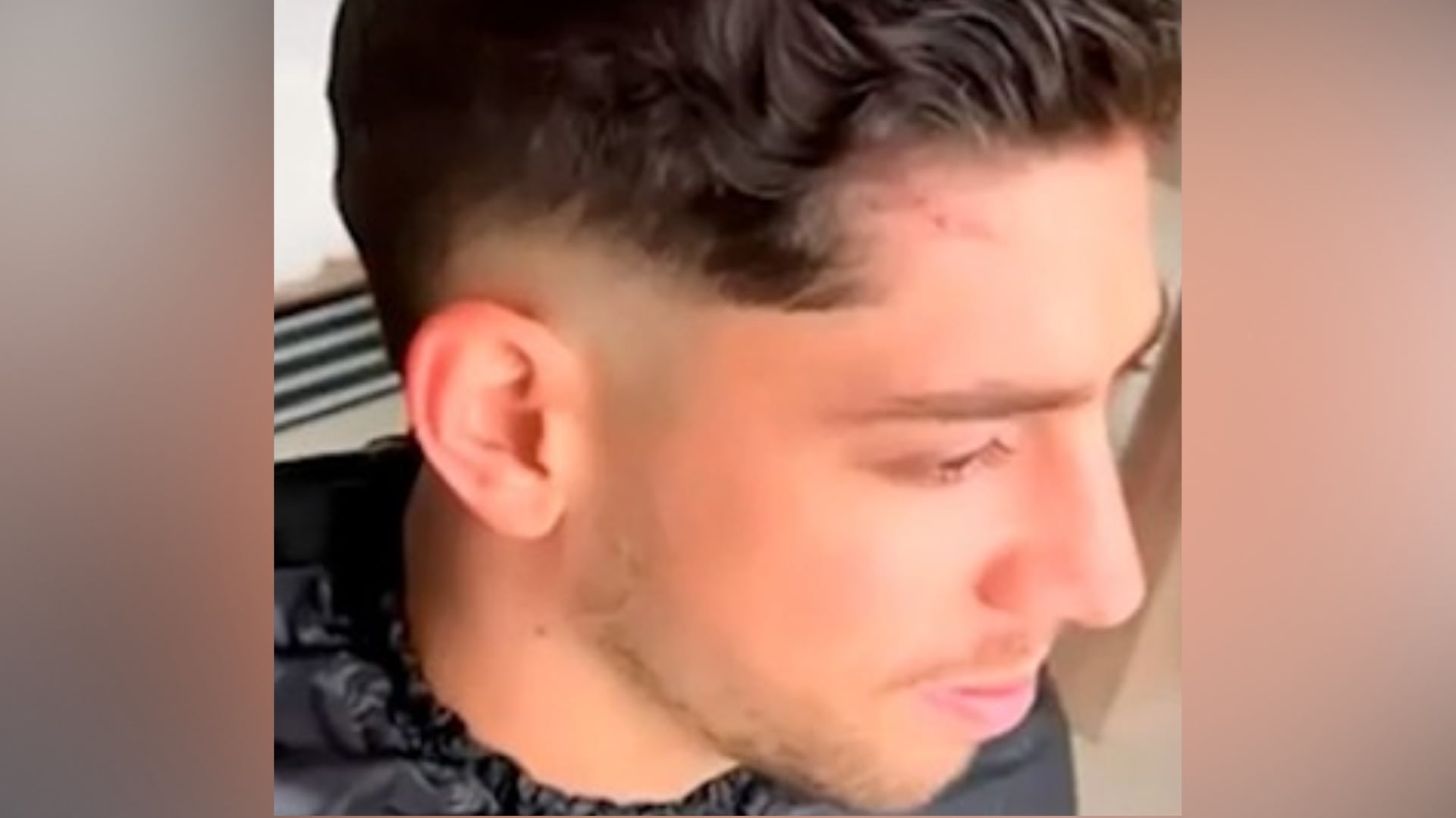 Con notoria cicatriz: Federico Valverde reaparece en Uruguay tras pelea con Aurélien Tchouaméni en el Real Madrid