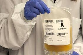 U de Chile inicia tratamiento de plasma con alto nivel de anticuerpos capaz de revertir avance del Covid-19 en pacientes críticos