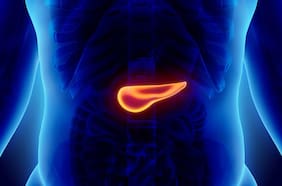 Cómo son los nuevos tratamientos contra el cáncer de páncreas que prometen ser efectivos, según ensayos clínicos