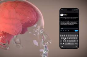 Elon Musk confirmó el primer implante de un chip cerebral en un humano