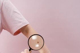 Trawa: la base de datos chilena creada con inteligencia artificial que detecta cáncer de piel en segundos