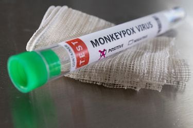 Estas son las tres formas más fáciles de contagiarse de la viruela del mono