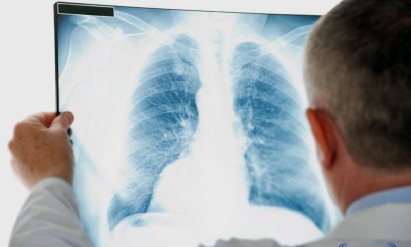 Radiografia torax web